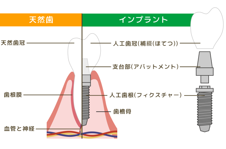 鏡をみて虫歯を気にしている女性